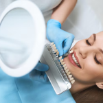top-5-reasons-why-dental-bonding-can-be-necessary