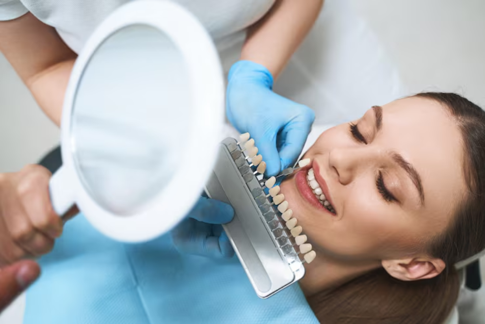 top-5-reasons-why-dental-bonding-can-be-necessary
