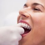what i wish i knew before dental implants