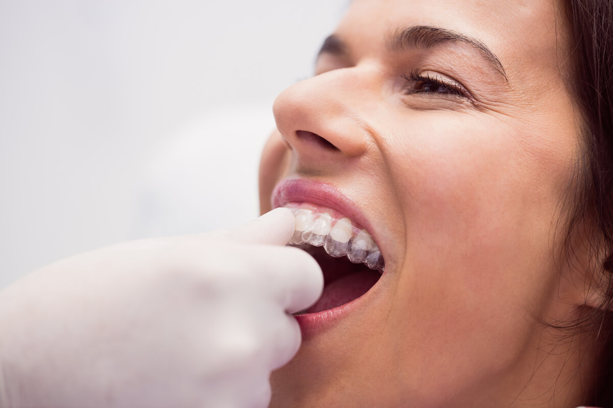 what i wish i knew before dental implants