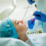 Sinus lift procedure
