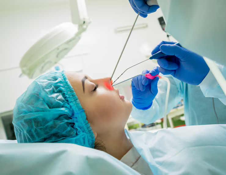 Sinus lift procedure